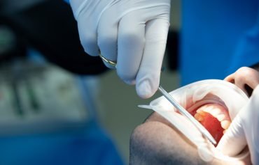 Chirurgie orale